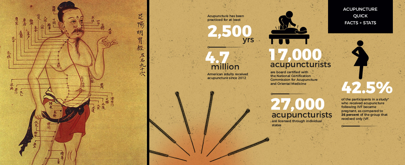 Culture Moving the Needle Needles photo 1