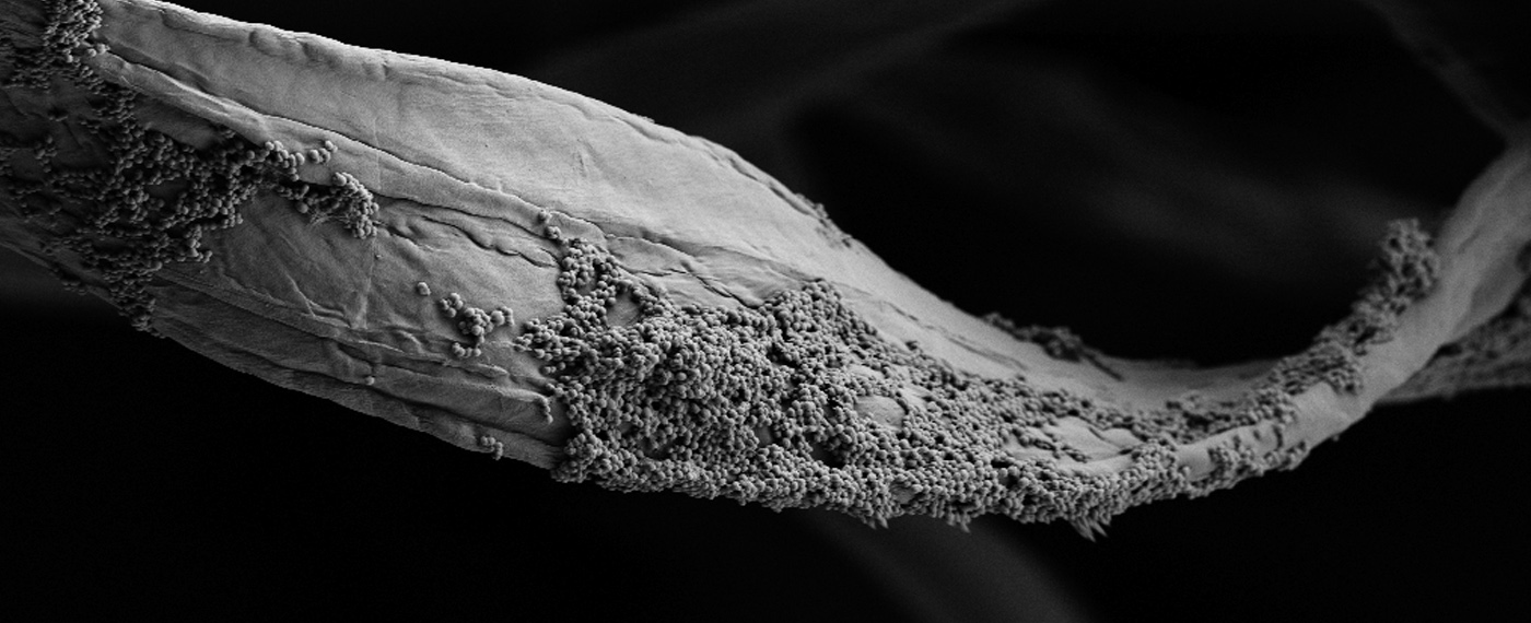 Special Advertisement Bozemans Microbion is Fighting to Save Lives Microbion photos 2